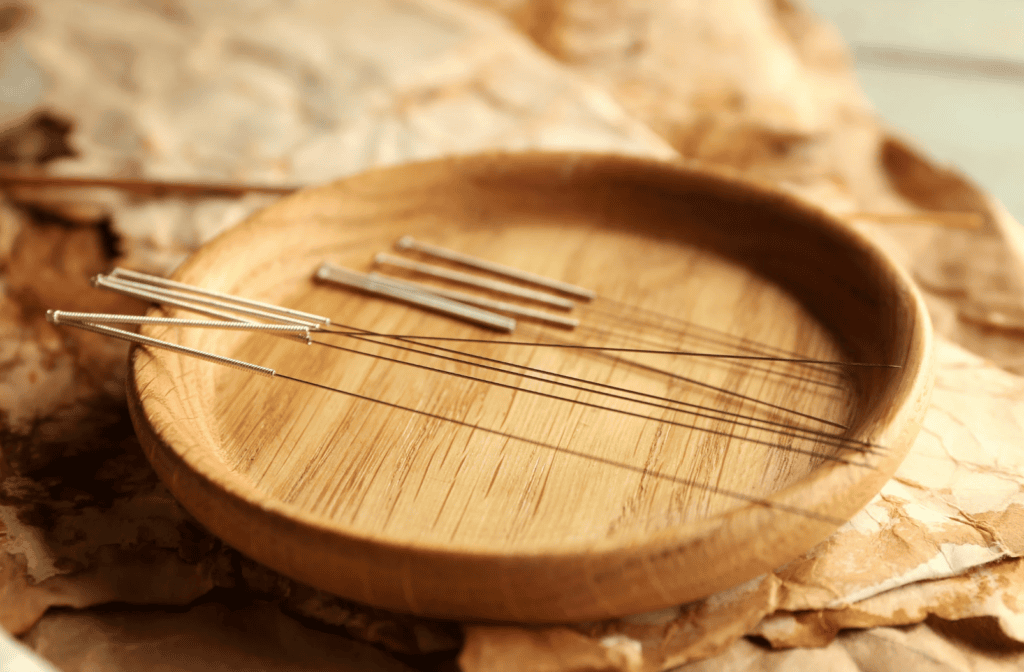 Thin acupuncture-style needles used in dry needling treatment, a technique often mistakenly believed to release toxins from muscles.