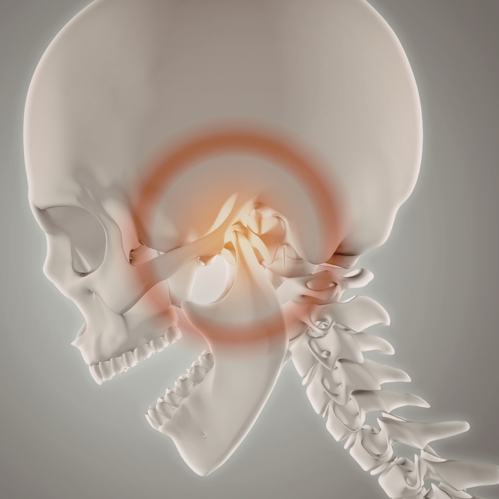 Medical illustration of the TMJ joint showing inflammation linked to headaches and migraines.